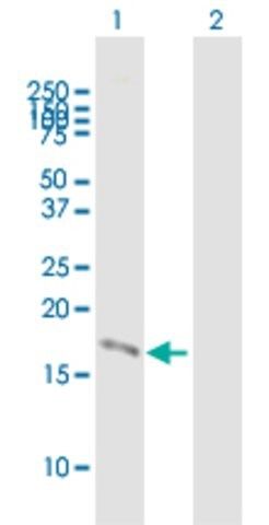 Anti-PSCA antibody produced in mouse