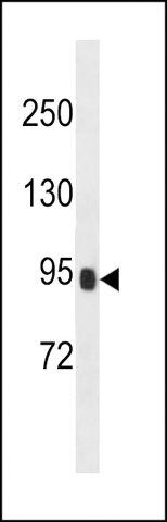 ANTI-PRSS36 (CENTER) antibody produced in rabbit