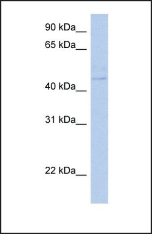 Anti-PSCD4, (N-terminal) antibody produced in rabbit