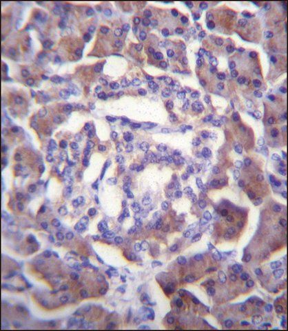 ANTI-PRSS3 (CENTER) antibody produced in rabbit