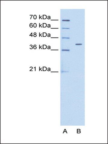 Anti-PSG6 antibody produced in rabbit