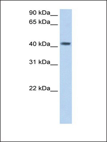 Anti-PSG5 antibody produced in rabbit