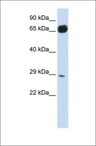 Anti-PRTFDC1 antibody produced in rabbit