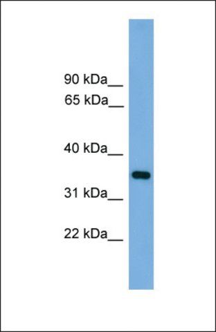 Anti-PRSS3, (N-terminal) antibody produced in rabbit