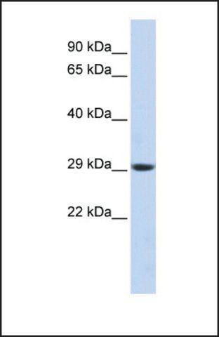 Anti-PSMA3 antibody produced in rabbit