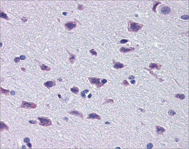 Anti-DMBX1 antibody produced in rabbit