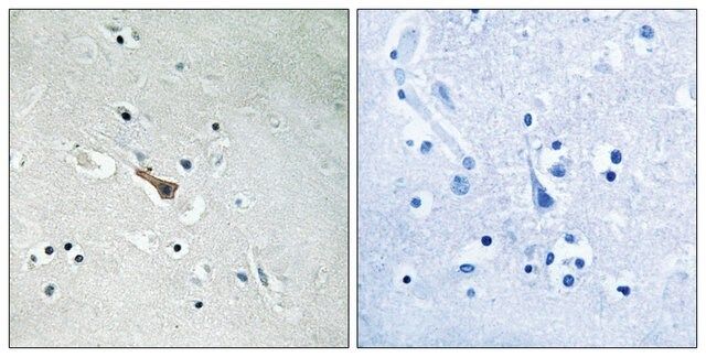 Anti-phospho-APLP2 (pTyr<sup>755</sup>) antibody produced in rabbit