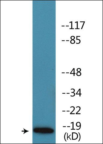 Anti-phospho-Caveolin 2 (pTyr<sup>27</sup>) antibody produced in rabbit