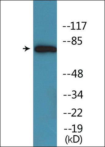 Anti-phospho-Arachidonate 5 Lipoxygenase (pSer<sup>271</sup>) antibody produced in rabbit