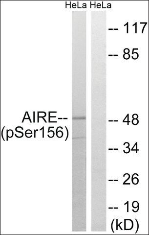 Anti-phospho-AIRE (pSer<sup>156</sup>) antibody produced in rabbit