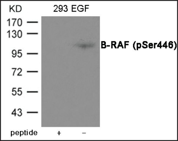 Anti-phospho-B-RAF (pSer<sup>446</sup>) antibody produced in rabbit