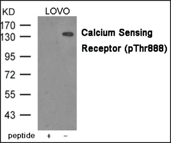 Anti-phospho-Calcium Sensing Receptor (pThr<sup>888</sup>) antibody produced in rabbit