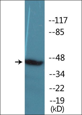 Anti-phospho-Caspase 9 (pTyr<sup>153</sup>) antibody produced in rabbit