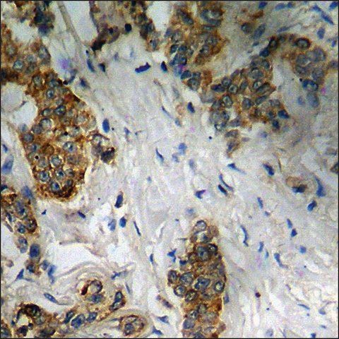 Anti-phospho-CD5 (pTyr<sup>453</sup>) antibody produced in rabbit