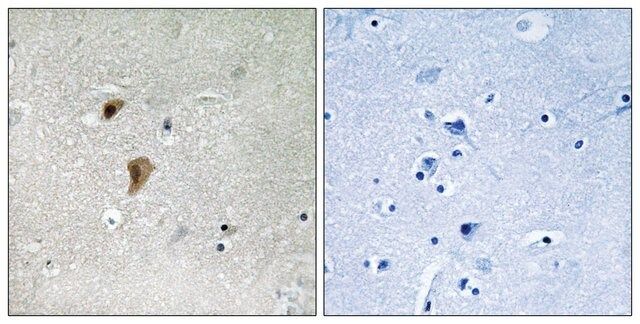 Anti-phospho-HSF1 (pThr<sup>142</sup>) antibody produced in rabbit