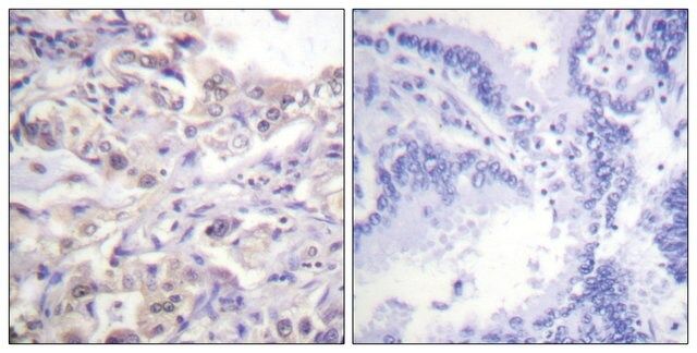 Anti-phospho-hnRPD (pSer<sup>83</sup>) antibody produced in rabbit