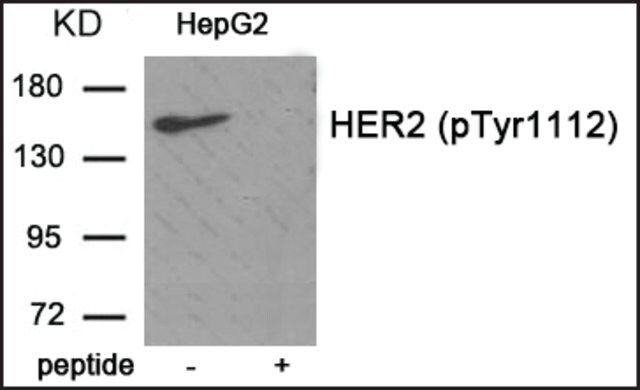 Anti-phospho-HER2 (pTyr<sup>1112</sup>) antibody produced in rabbit