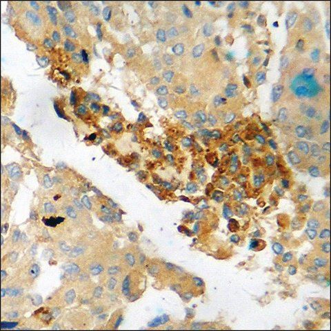 Anti-phospho-HSP27 (pSer<sup>15</sup>) antibody produced in rabbit