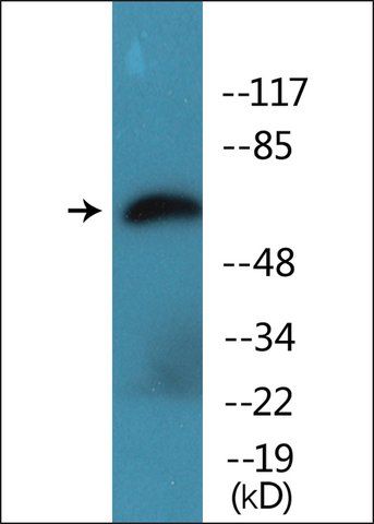 Anti-phospho-IL-10R  (pTyr<sup>496</sup>) antibody produced in rabbit