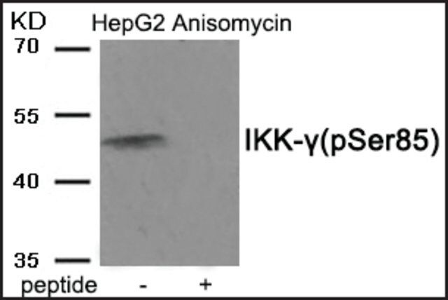 Anti-phospho-IKK- (pSer<sup>85</sup>) antibody produced in rabbit