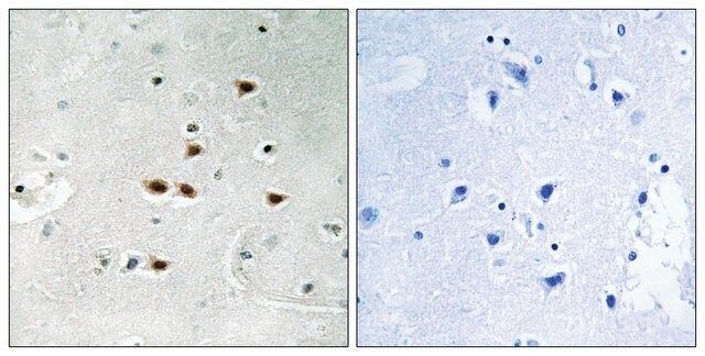 Anti-phospho-ITCH (pTyr<sup>420</sup>) antibody produced in rabbit