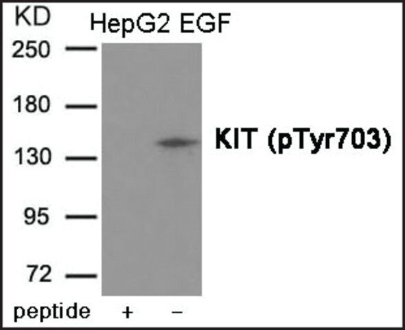 Anti-phospho-KIT (pTyr<sup>703</sup>) antibody produced in rabbit