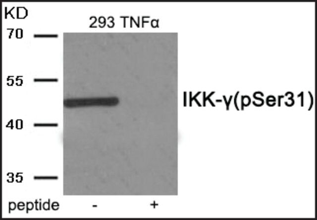 Anti-phospho-IKK- (pSer<sup>31</sup>) antibody produced in rabbit