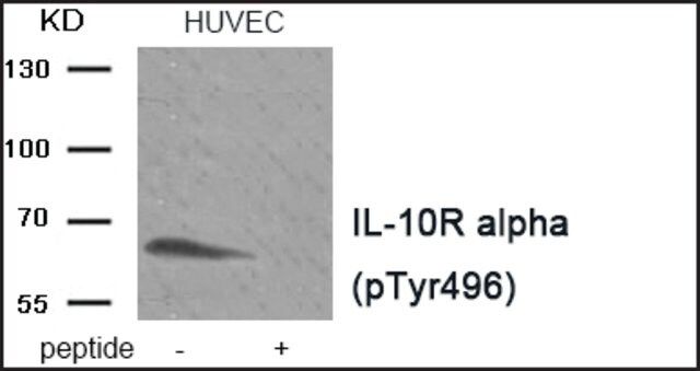 Anti-phospho-IL-10R  (pTyr<sup>496</sup>) antibody produced in rabbit