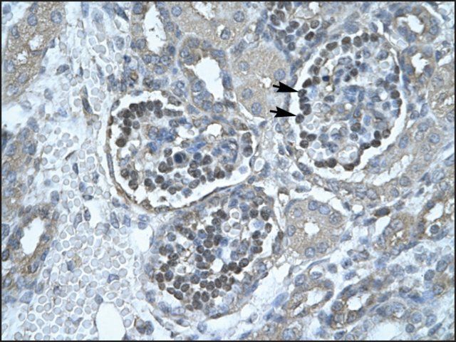 Anti-PNLIP (AB2) antibody produced in rabbit