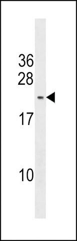 ANTI-PMS2L5(C-TERMINAL) antibody produced in rabbit