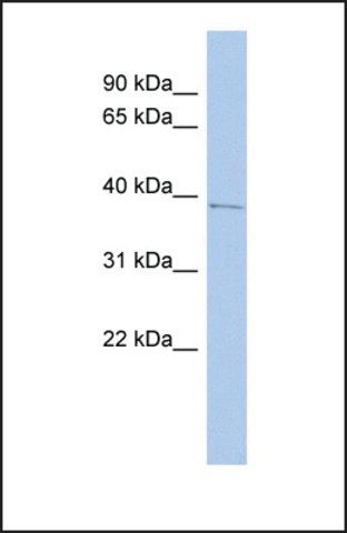 Anti-PNMA1 antibody produced in rabbit