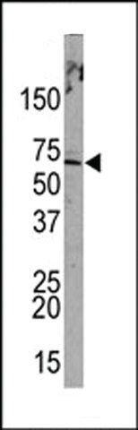 Anti-PML Sumoylation Site antibody produced in rabbit