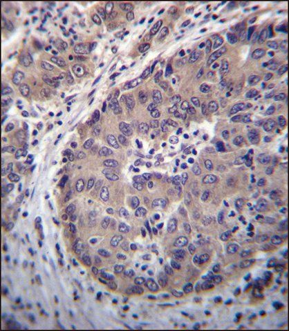 ANTI-PNLIPRP3 (N-TERM) antibody produced in rabbit