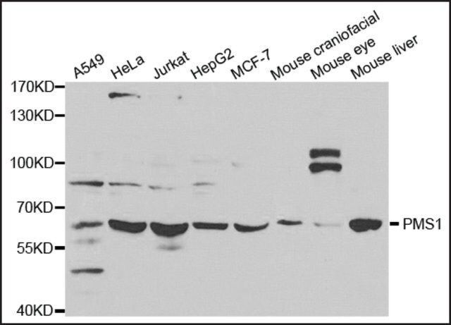 Anti-PMS1 antibody produced in rabbit