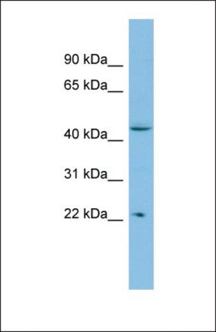 Anti-POLR1E, (N-terminal) antibody produced in rabbit