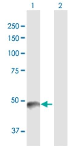 Anti-PNLIP antibody produced in rabbit