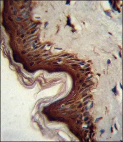 ANTI-PPL (C-TERM) antibody produced in rabbit