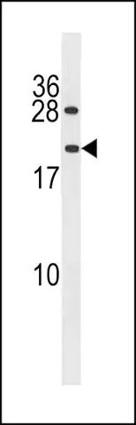 ANTI-PPIAL4A(N-TERMINAL) antibody produced in rabbit