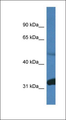 Anti-PPP2R2D antibody produced in rabbit