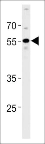 ANTI-PPHLN1(N-TERMINAL) antibody produced in rabbit