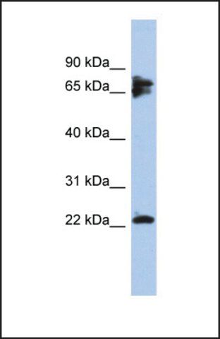 Anti-PPP3R1, (N-terminal) antibody produced in rabbit