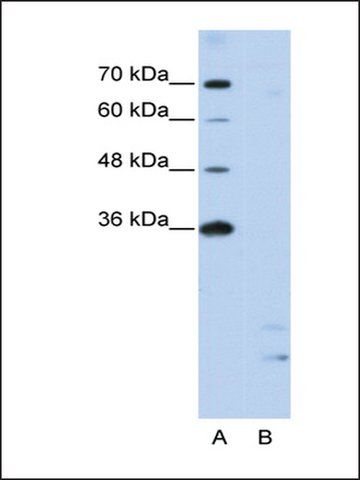 Anti-PPIE (AB1) antibody produced in rabbit