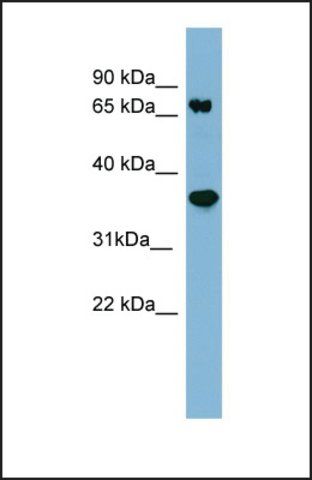 Anti-PPP2R1B, (N-terminal) antibody produced in rabbit