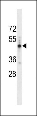 ANTI-PRAMEF14 (CENTER) antibody produced in rabbit