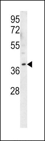 ANTI-OR2AK2 (C-TERM) antibody produced in rabbit