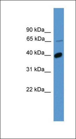 Anti-OR2B2 antibody produced in rabbit