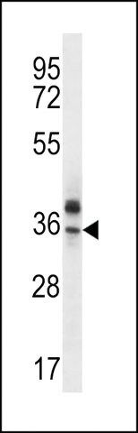 ANTI-OR51Q1(N-TERMINAL) antibody produced in rabbit