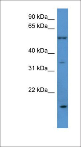 Anti-OR2J2 antibody produced in rabbit