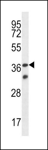 ANTI-OR4X2 (C-TERM) antibody produced in rabbit