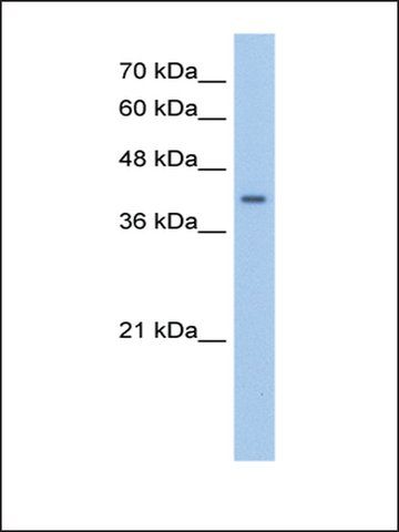 Anti-PHACS antibody produced in rabbit